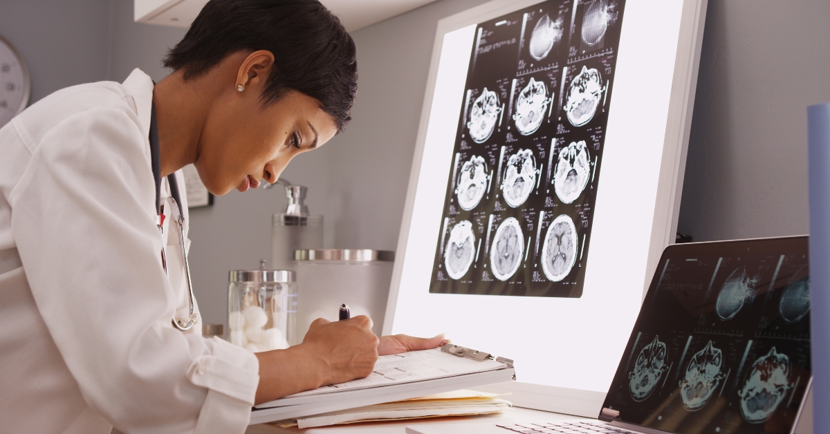 medical woman reading x-ray results of a brain