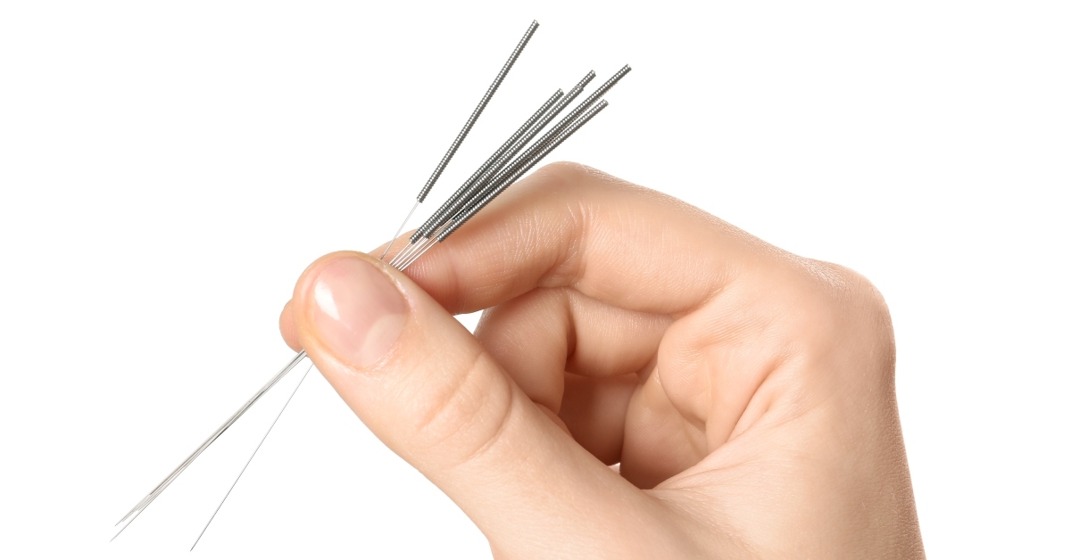 woman holding needles for acupuncture