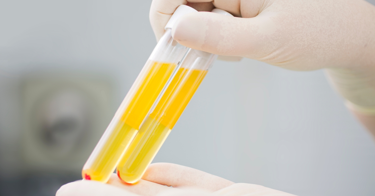 blood plasma in test tubes