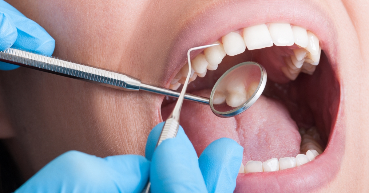 teeth and cleaning tools